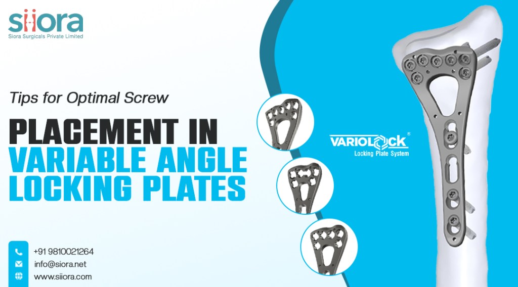 Variable Angle Locking Plates